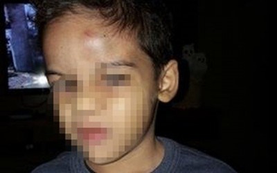 Mulher é ameaçada após acidente envolvendo filho e outra criança na escola