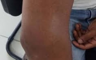 Briga de trânsito termina em agressão em Três Lagoas