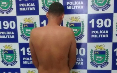 Mulher é espancada pelo marido e acaba internada no Hospital Auxiliadora 