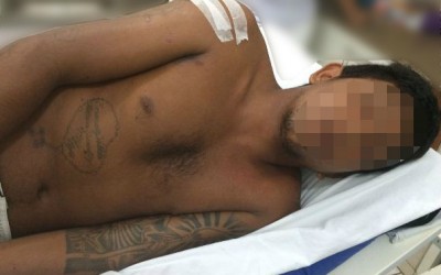 Jovem sofre tentativa de homicídio e diz “vou cobrar essa fita do vacilão”