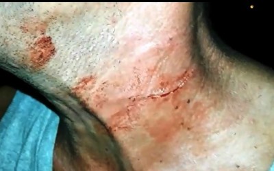 Nove horas depois de ser ferido com uma pá, homem é amarrado durante assalto