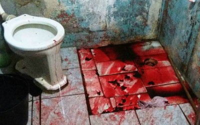 Idosa é encontrada gravemente ferida dentro do banheiro de residência