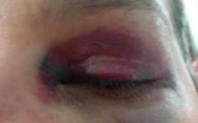  Ao tentar defender a sogra, genro apanha em briga de família no Jardim Alvorada 