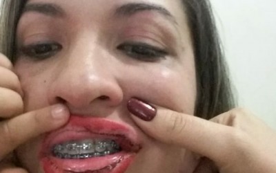 Jornalista posta vídeo em rede social acusando companheiro de violência doméstica