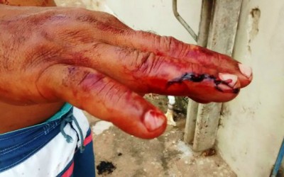 Ao proteger a enteada, padrasto é agredido por jovem no bairro Vila Nova