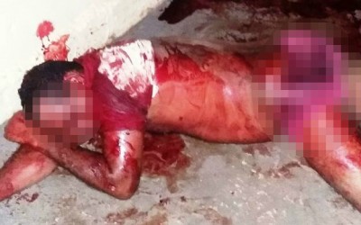 Homem invade a casa da ex e após briga, leva 10 facadas