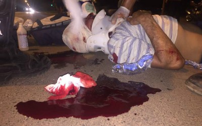 Ciclista é socorrido em estado grave após ser atingido por veículo 