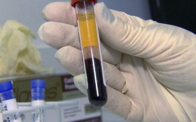 Saúde possui testes rápidos para diagnóstico da dengue