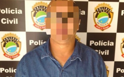 Enfurecido homem arremessa celular no rosto de esposa que tem suspeita de fratura