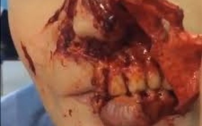 Jovem de 18 anos leva tiro no rosto durante briga com marido