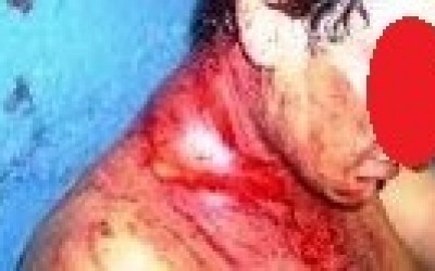 Cliente de bar no Santa Rita apanha e não sabe dizer quem é o acusado das agressões