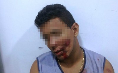 Jovem embriagado que sofreu acidente dorme durante o registro da ocorrência 