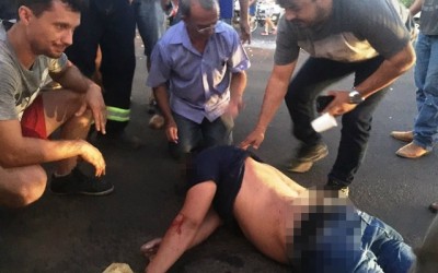 Dono de pizzaria fica gravemente ferido após se envolver em acidente 