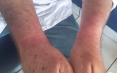 Grupo invade rancho, espanca caseiro e foge levando espingarda de pressão