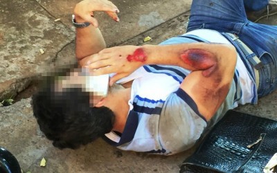 Gerente de empresa de ar condicionado sofre acidente com moto no bairro Vila Nova 