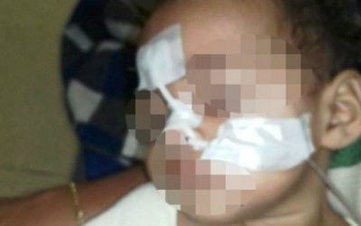 Menina que nasceu com os dois sexos passa por cirurgia e luta pela sobrevivência