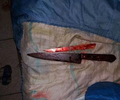 Mulher corta pênis do próprio irmão no Paraná