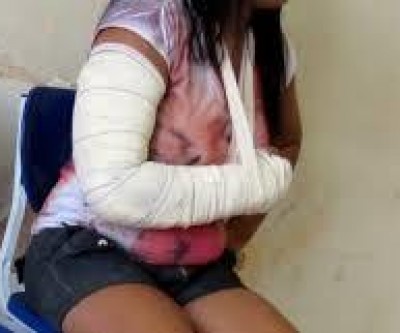 Após bebedeira em bar, mulher é espancada pelo marido no bairro Vila Alegre 