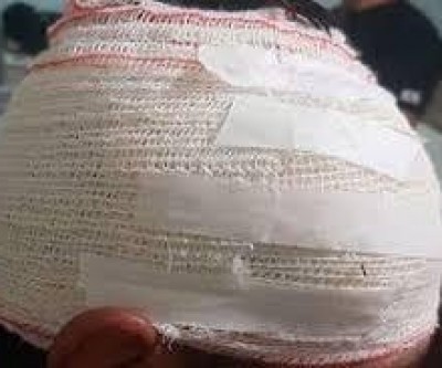 Cego de ciúmes homem se esconde em matagal à espera de sua vítima e o agride a pauladas