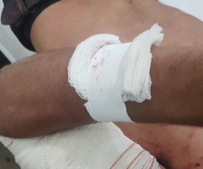 Dívida de R$ 10,00 termina em briga e duas pessoas esfaqueadas