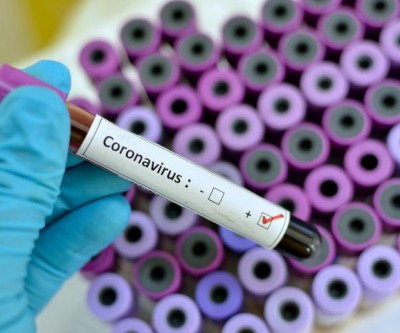 Três Lagoas registra mais dois casos positivos para Covid-19 e pula para 41 casos positivos 