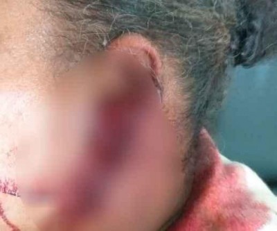 Após suspeita de traição mulheres brigam e uma delas é agredida com golpes de lanterna 