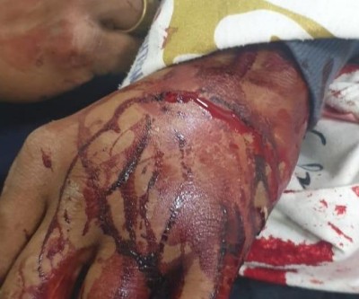 Homem em moto dispara três tiros contra pedestre no bairro Guanabara 