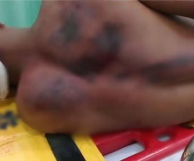 Em Andradina, adolescente é espancado por padrasto ao entrar em briga para defender a mãe