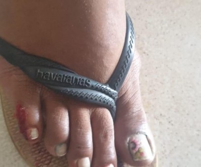 Após atropelar ex-mulher, homem agride vítima que ainda estava caída no chão 