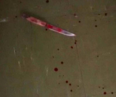 Mulher arranha testículos de companheiro durante briga