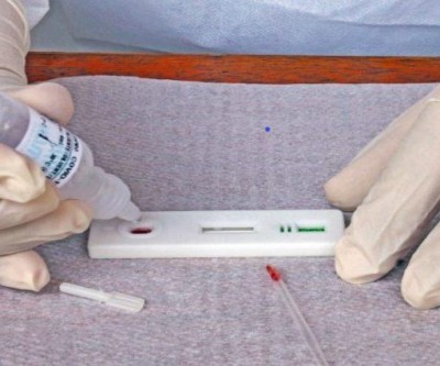 SES registra 2,6 mil casos e 16 novos óbitos por Covid