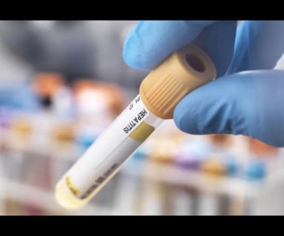 Organização Mundial de Saúde descobre nova cepa da hepatite e confirma 169 casos da doença