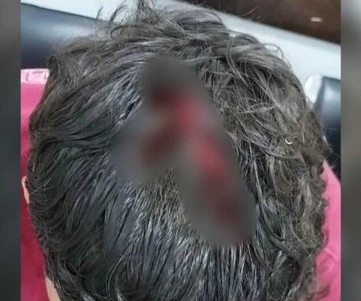 Jovem é baleado cinco vezes e fica em estado grave em Sonora  