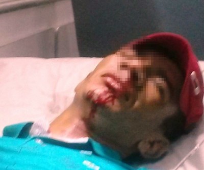 Jovem esfaqueado no Interlagos morre no Hospital Auxiliadora