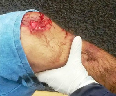 Homem colide em veículo que parou para pedestre fazer travessia