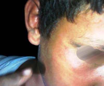 Menino de 10 anos é agredido a capacetadas pelo próprio pai