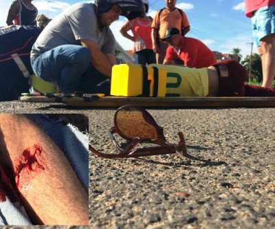 Jovem sofre fratura exposta ao bater em Corolla no bairro Colinos 