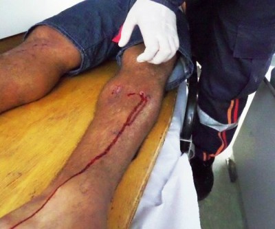 Motociclista em Hornet colide contra pickup e fica ferido