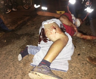 Acidente na BR-262 resulta em múltiplas fraturas em motociclista 