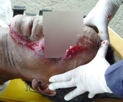 Idoso de 67 anos é atropelado no Bairro JD. Maristela e condutor foge do local