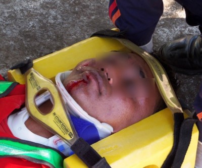 Moto entregador fica ferido em colisão entre carro e moto no Bairro Vila Nova