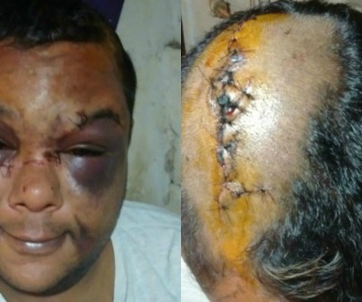 ‘’Saímos para matar veado’’, diziam agressores de homossexual em Três Lagoas