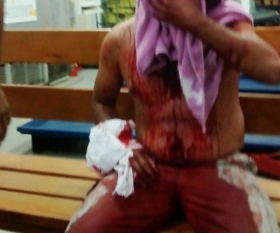 Homem tem rosto desfigurado ao ser ferido com caco de vidro