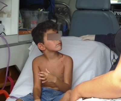 Menino de 06 anos cai de brinquedo e sofre traumatismo craniano