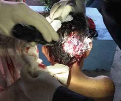 Boxer tem dia de fúria e ataca o próprio dono em residência na Rua 15 de Junho 