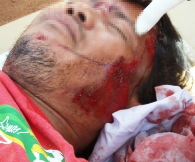 Ciclista é atingido por carro na BR-262 em Três Lagoas 