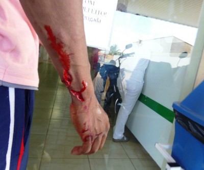 Fugitivo da Gameleira tenta realizar furto e fica gravemente ferido