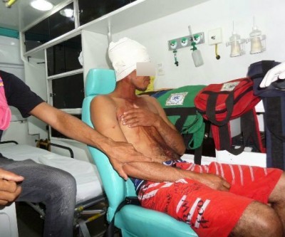 Homem embriagado sofre ferimento na cabeça ao cair dentro da própria casa