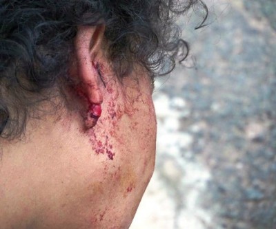 Marido corta a orelha de mulher grávida após briga em via pública 