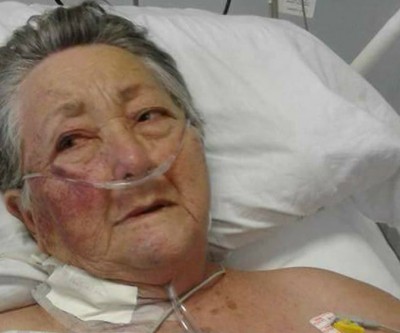 Idosa de 78 anos é agredida por enfermeiro de UTI em SP